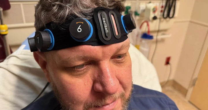 Revolutionising Epilepsy Diagnosis: AI-Powered Brain Monitoring at Providence Hospitals